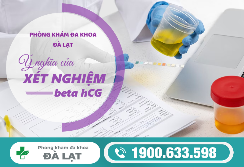 Hình ảnh minh họa